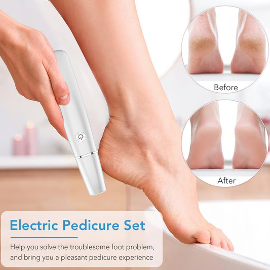 🔥75% OFF LAST DAY! Electric Foot Callus Remover – Get Silky Smooth Heels Fast